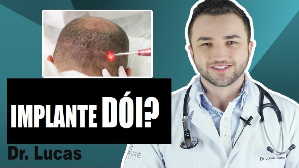 Implante Capilar Descubra Se O Procedimento Doi Muito Ou N O Implantes Capilares Toda A